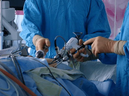 Kirurški poseg